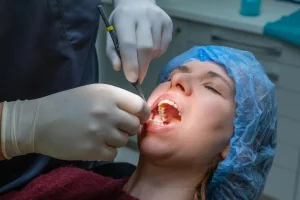 wisdom tooth extraction